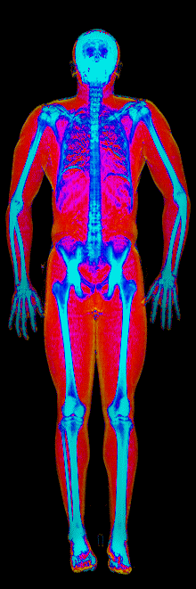 Male fat loss number 3 DEXA scan after at 155 lb and 15.2 percent body fat