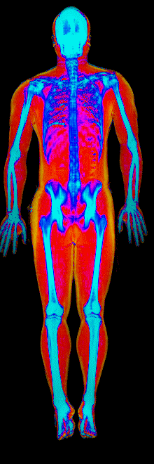 Male muscle gain number 1 DEXA scan after at 184 lb and 22.5 percent body fat