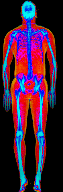Male muscle gain number 2 DEXA scan after at 191 lb and 21.6 percent body fat