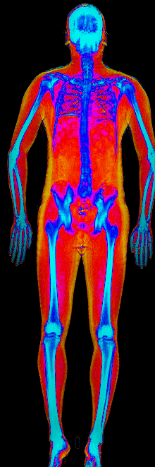 Male muscle gain number 2 DEXA scan before at 188 lb and 26.9 percent body fat