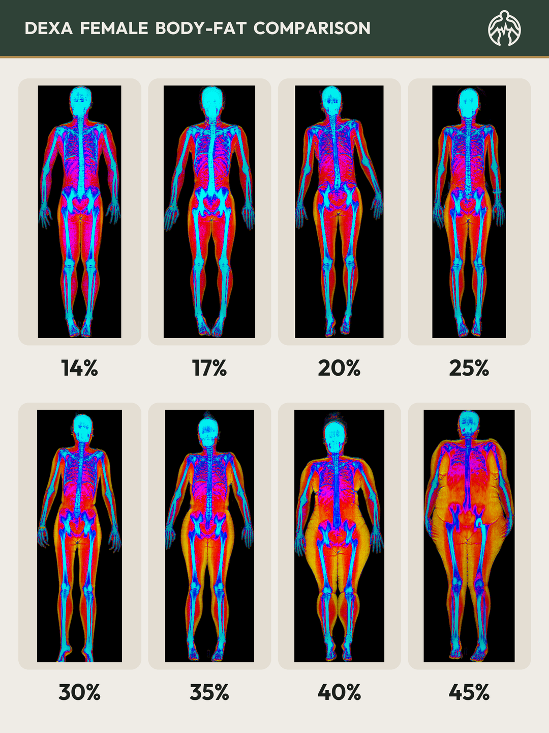 DEXA female body-fat comparison: real scans from 14% to 45% body fat