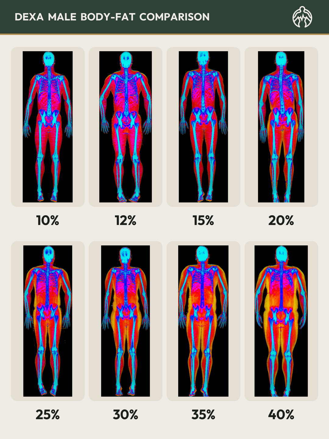 DEXA male body-fat comparison: real scans from 10% to 40% body fat