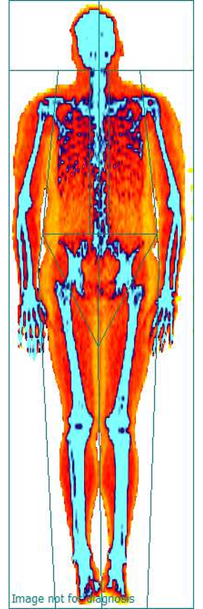 Anonymized GE Lunar dashboard colour DEXA scan example reported at 28.9 percent body fat.