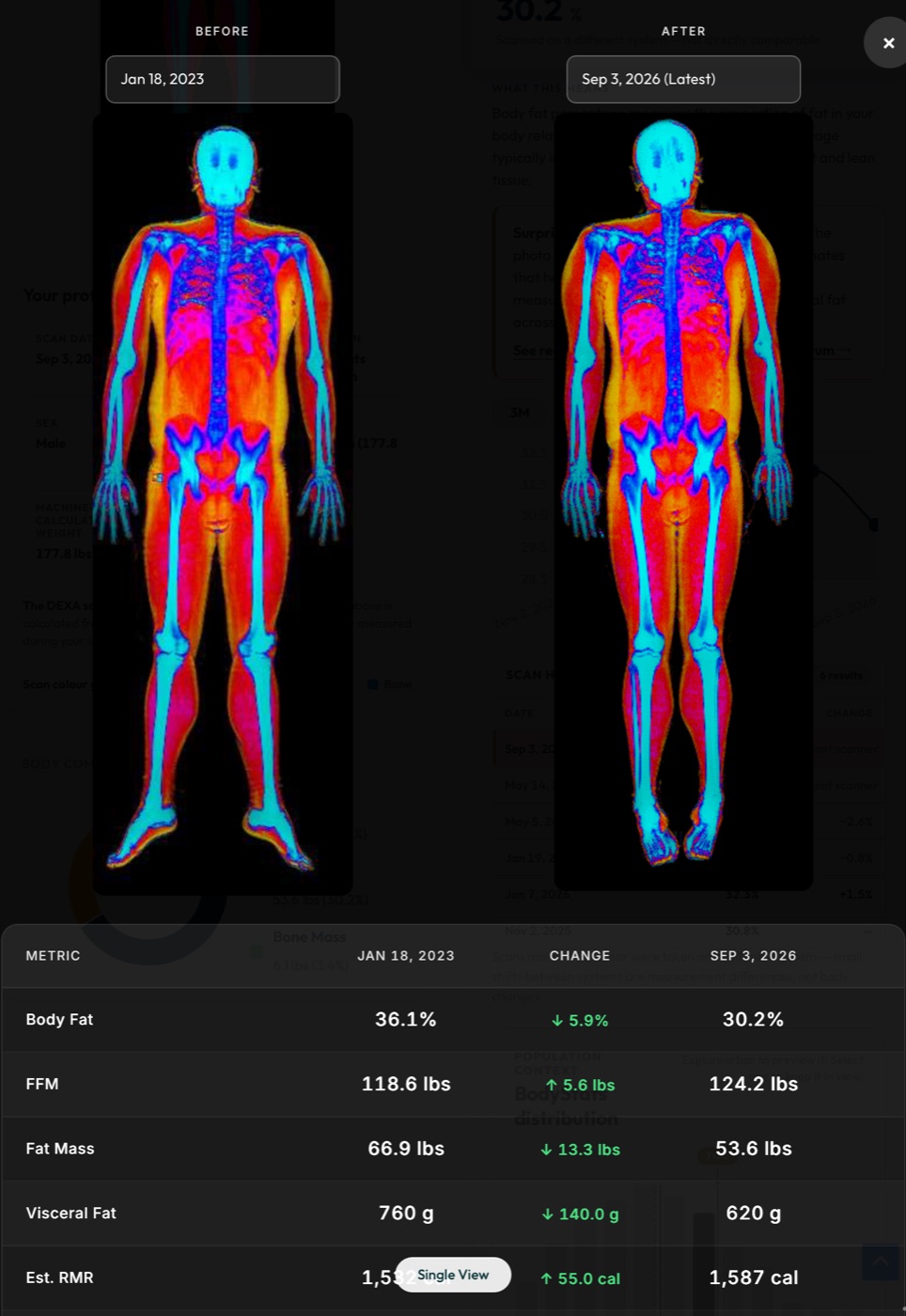 Before and after comparison of two DEXA scans